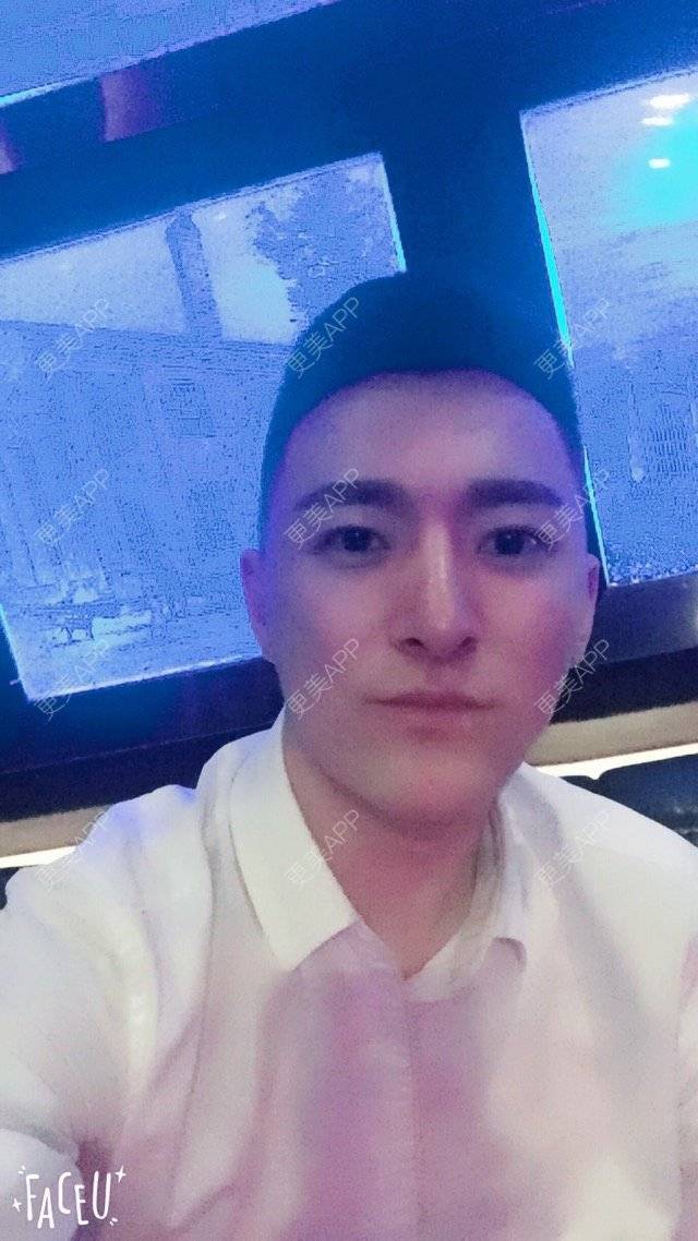 更美 - 柳安花明又一村的玻尿酸额头经验 | 长沙 | 玻尿酸额头