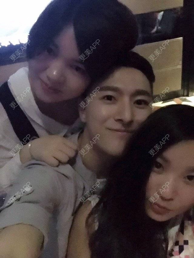 更美 - 柳安花明又一村的玻尿酸额头经验 | 长沙 | 玻尿酸额头