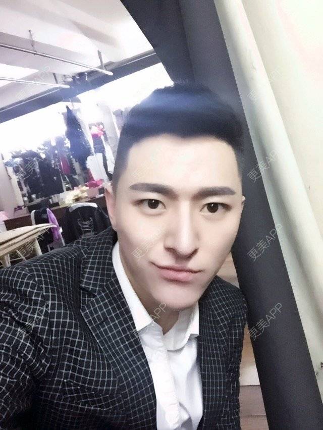 更美 - 柳安花明又一村的玻尿酸额头经验 | 长沙 | 玻尿酸额头