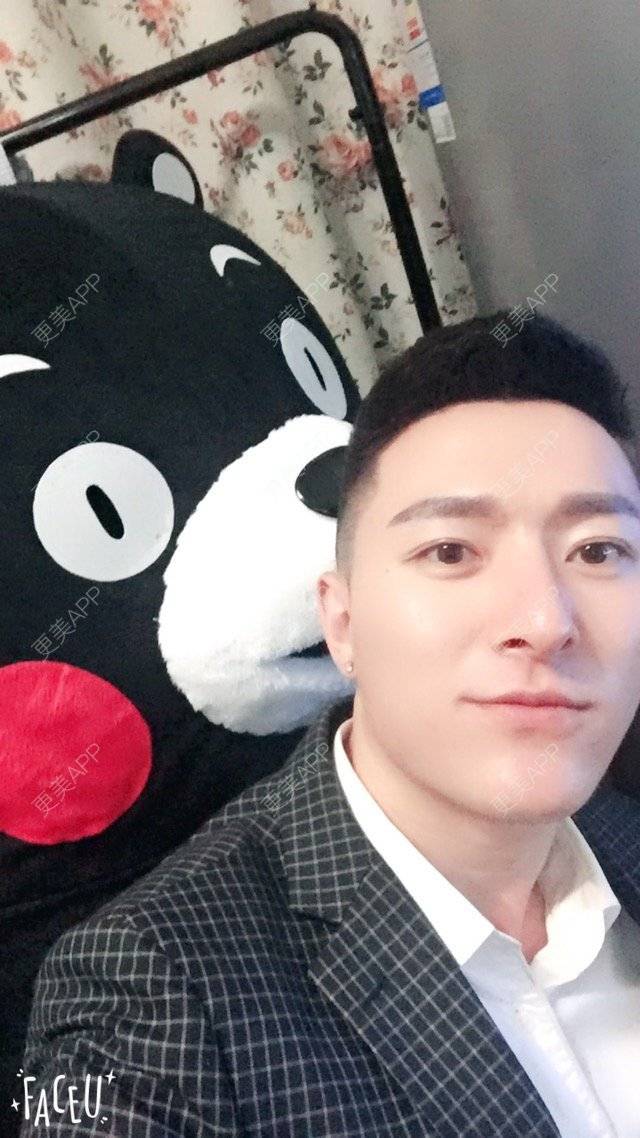 更美 - 柳安花明又一村的玻尿酸额头经验 | 长沙 | 玻尿酸额头