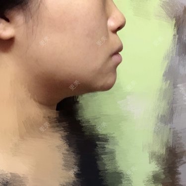 ROU_rou