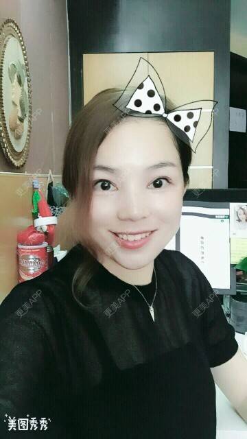 更美 - 小明不再是小明的全切双眼皮经验 | 切开割双眼皮 | 深圳 | 全切双眼皮 | 全切开双眼皮