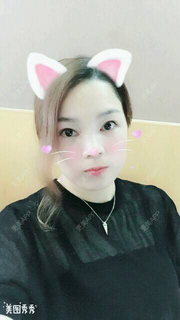 更美 - 小明不再是小明的全切双眼皮经验 | 切开割双眼皮 | 深圳 | 全切双眼皮 | 全切开双眼皮