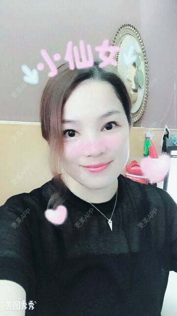 更美 - 小明不再是小明的全切双眼皮经验 | 切开割双眼皮 | 深圳 | 全切双眼皮 | 全切开双眼皮