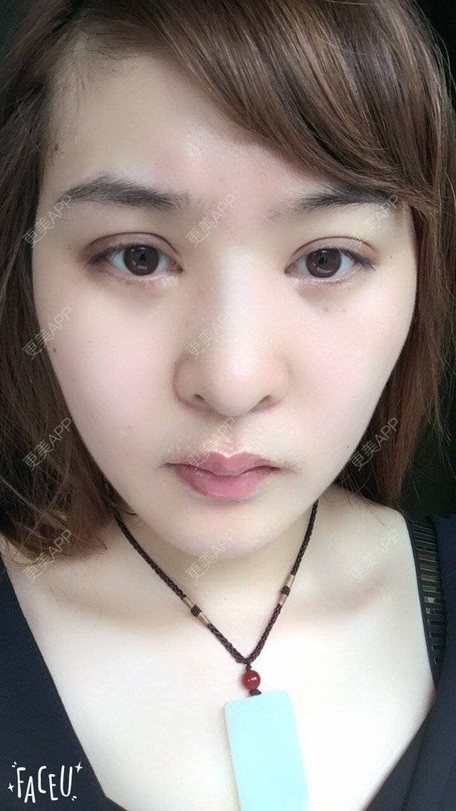 更美 - 更美用户6faqZc1v9C的经验 | 重庆
