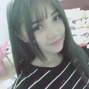 隆鼻