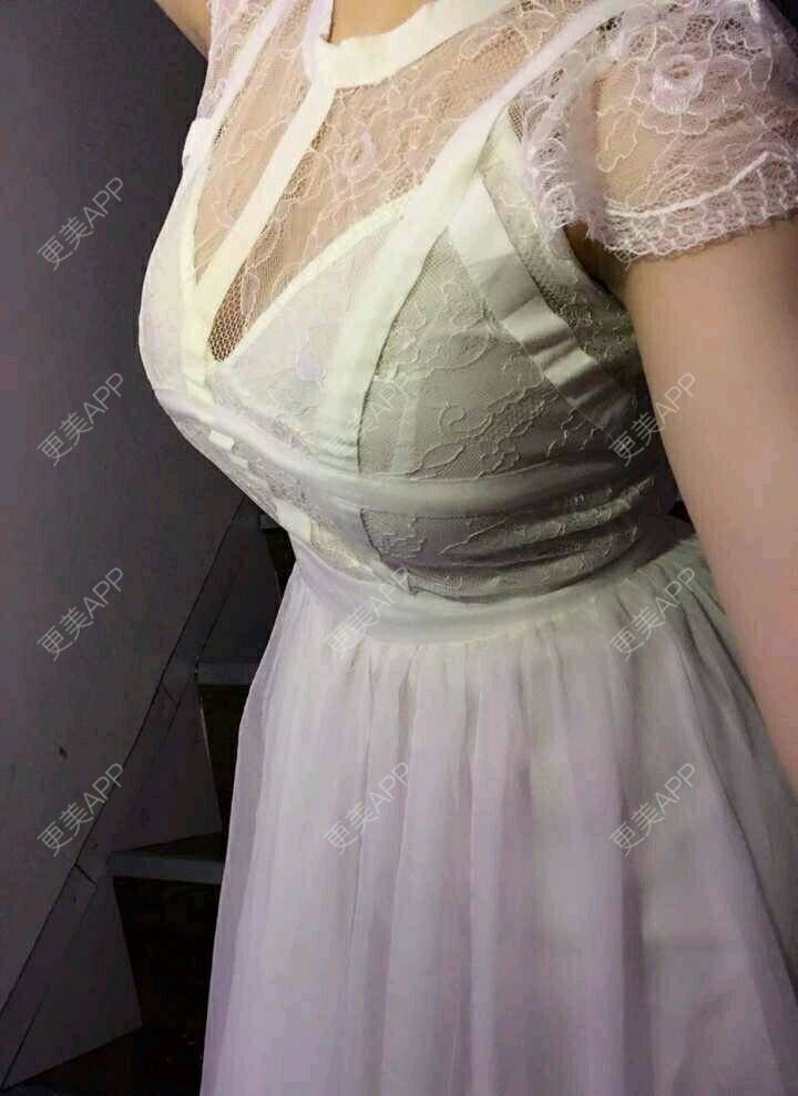 就是爱吃土豆的自体脂肪隆胸日记