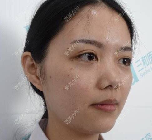 更美 - 湖南乐小妖医疗美容有限公司的水光项目经验 | 株洲 | 水光项目