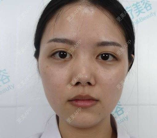 更美 - 湖南乐小妖医疗美容有限公司的水光项目经验 | 株洲 | 水光项目