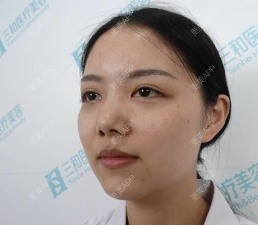 更美 - 湖南乐小妖医疗美容有限公司的水光项目经验 | 株洲 | 水光项目
