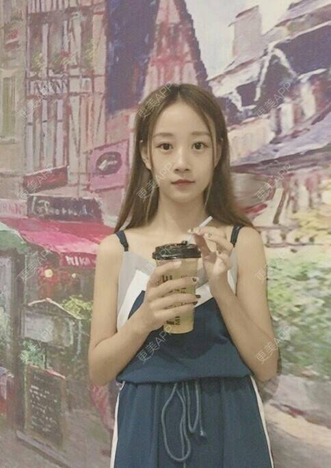 更美 - 光年之外er的淡斑套餐经验 | 淡斑套餐 | 上海