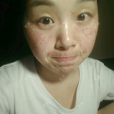 艳艳小芒果