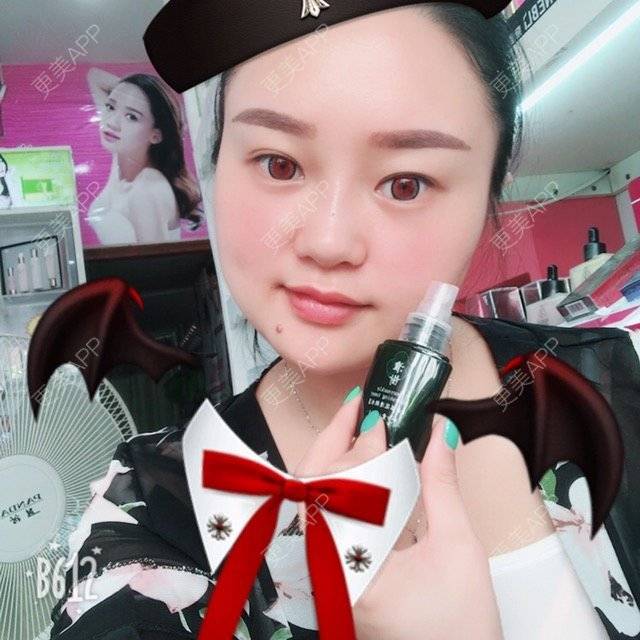 更美 - 更美用户LXBe7XUMWQ的玻尿酸鼻部经验 | 成都 | 玻尿酸鼻部 | 瘦脸类