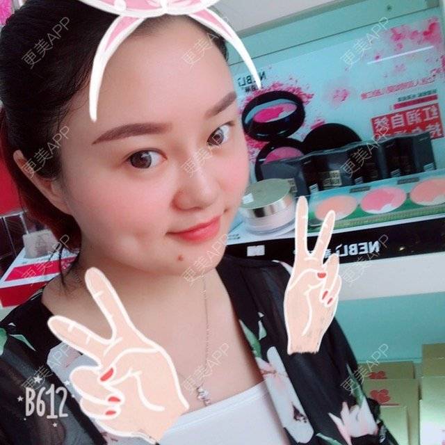 更美 - 更美用户LXBe7XUMWQ的玻尿酸鼻部经验 | 成都 | 玻尿酸鼻部 | 瘦脸类