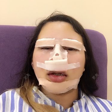 竹攸