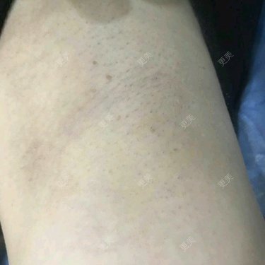 更美用户kNZTUxA9fD