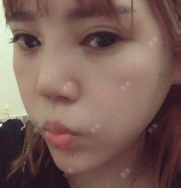 BabyfaceTT