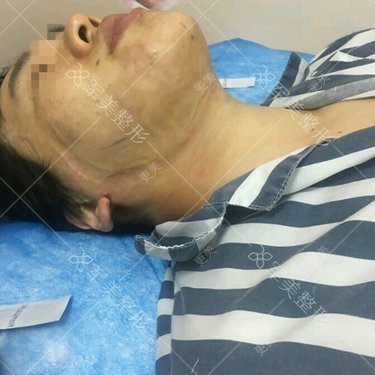 王世虎 医生