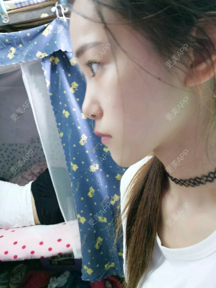 更美 - 更美用户vweUGm53qh的经验 | 晒侧颜 | 面部轮廓 | 口腔齿科 | 成都