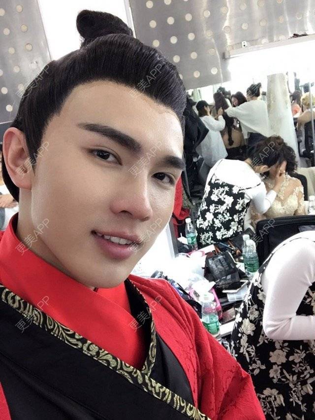 更美 - 笑笑笑水阁的玻尿酸额头经验 | 玻尿酸额头 | 长沙