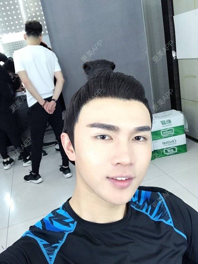 更美 - 笑笑笑水阁的玻尿酸额头经验 | 玻尿酸额头 | 长沙