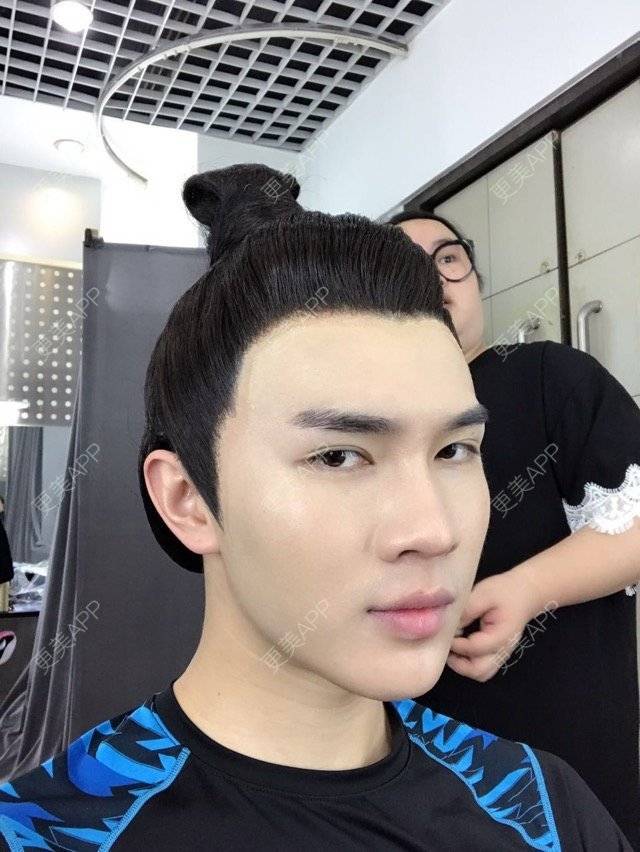 更美 - 笑笑笑水阁的玻尿酸额头经验 | 玻尿酸额头 | 长沙