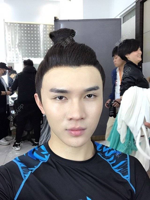 更美 - 笑笑笑水阁的玻尿酸额头经验 | 玻尿酸额头 | 长沙