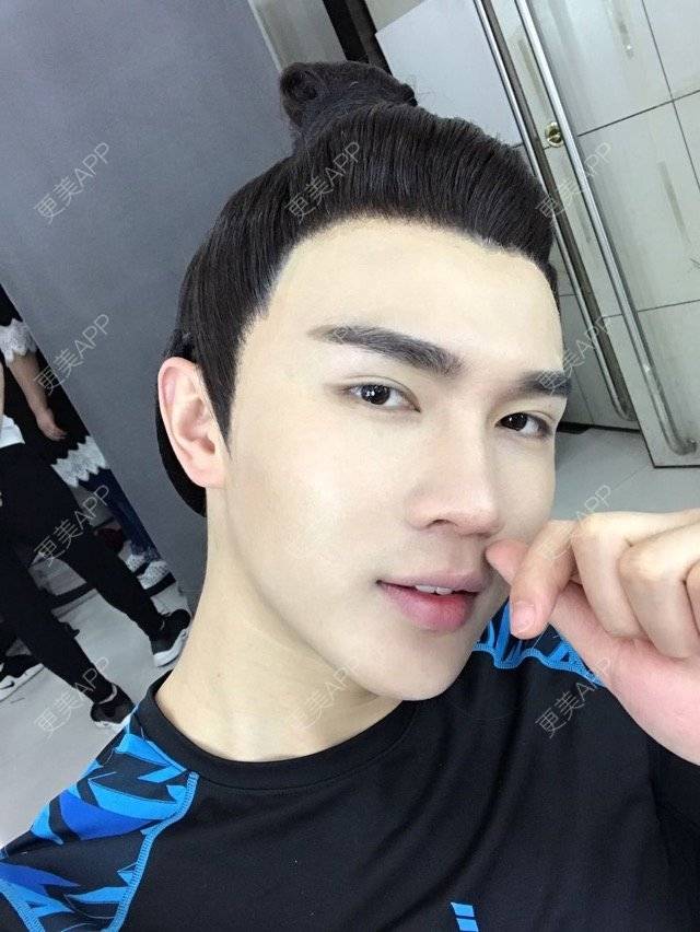 更美 - 笑笑笑水阁的玻尿酸额头经验 | 玻尿酸额头 | 长沙