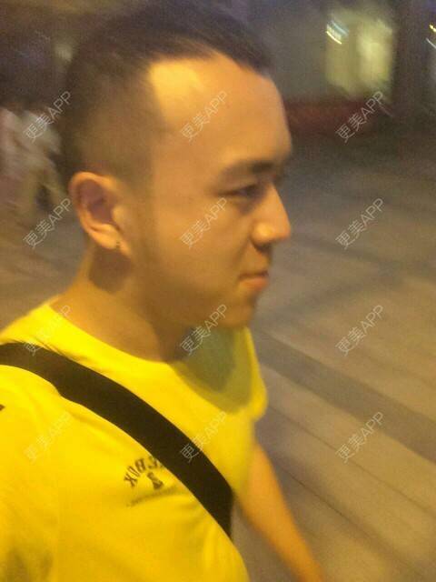更美 - 王涛 医生的经验 | 成都