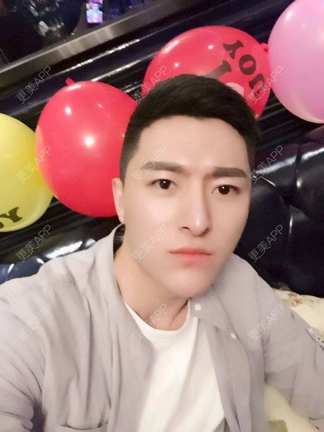 更美 - 柳安花明又一村的玻尿酸额头经验 | 长沙 | 玻尿酸额头