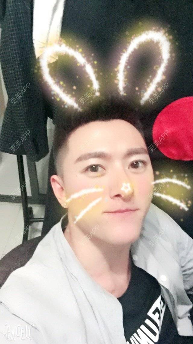 更美 - 柳安花明又一村的玻尿酸额头经验 | 长沙 | 玻尿酸额头