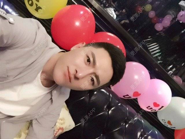 更美 - 柳安花明又一村的玻尿酸额头经验 | 长沙 | 玻尿酸额头