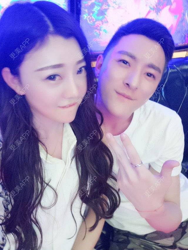 更美 - 柳安花明又一村的玻尿酸额头经验 | 长沙 | 玻尿酸额头