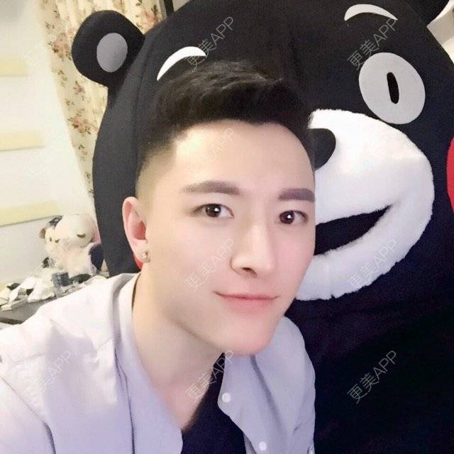 更美 - 柳安花明又一村的玻尿酸额头经验 | 长沙 | 玻尿酸额头