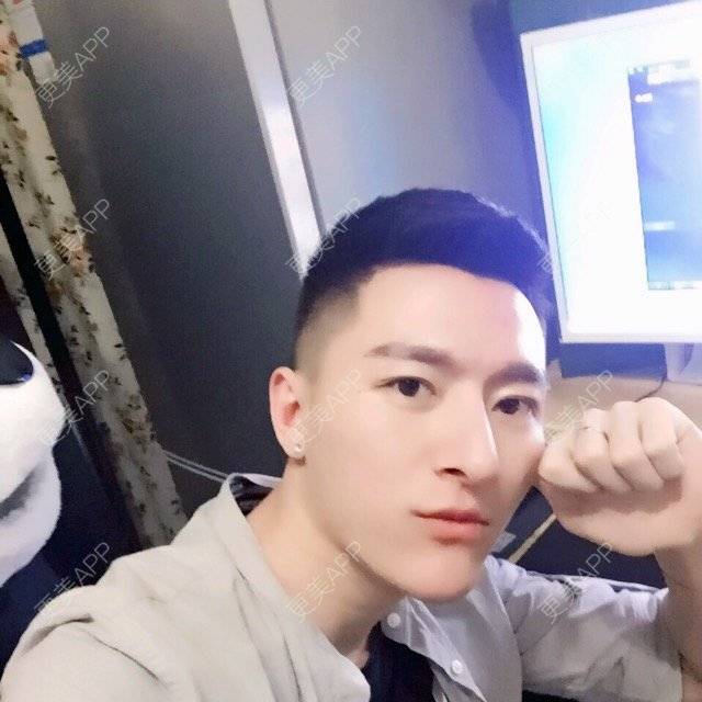 更美 - 柳安花明又一村的玻尿酸额头经验 | 长沙 | 玻尿酸额头