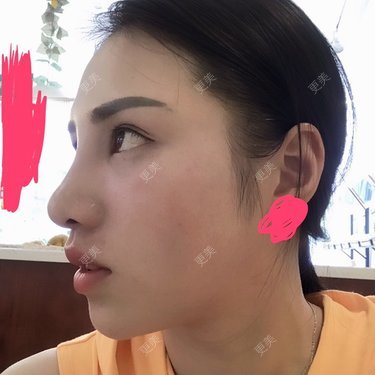 小棉袄cc升级日记