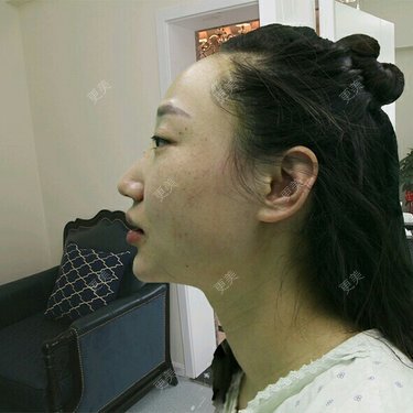 洪梁健 医生