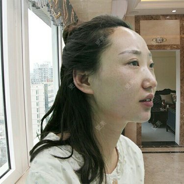 洪梁健 医生