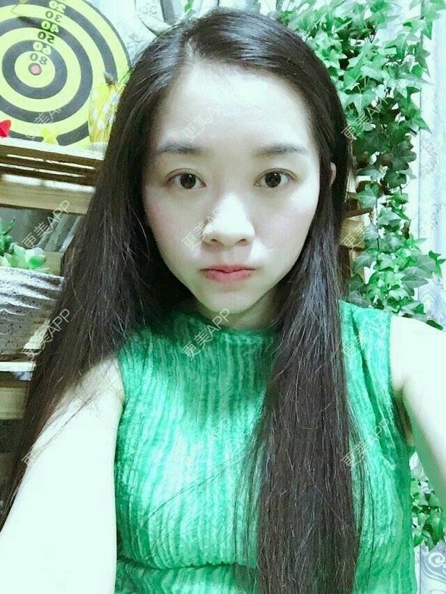更美 - 彩小文的除皱瘦脸经验 | 瘦脸除皱 | 注射瘦脸· | 除皱瘦脸 | 北京