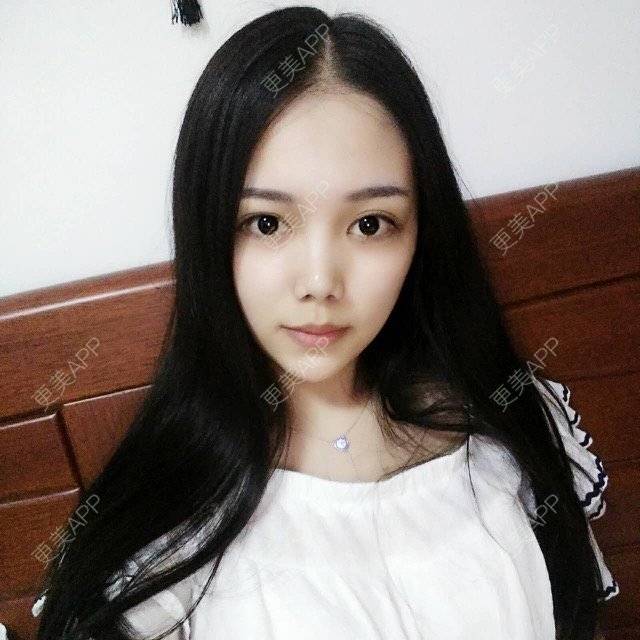更美 - 湖南乐小妖医疗美容有限公司的水光项目经验 | 株洲 | 水光项目