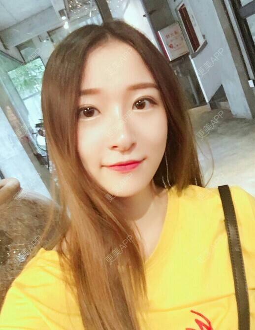 更美 - 月半小猫的淡斑套餐经验 | 淡斑套餐 | 上海