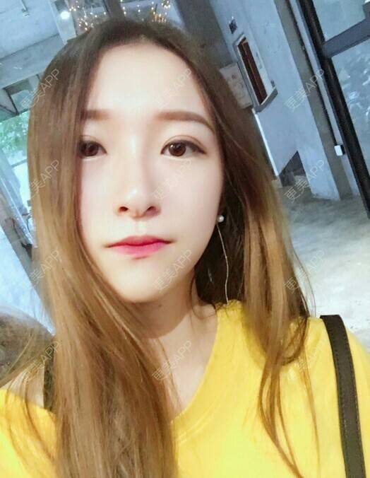 更美 - 月半小猫的淡斑套餐经验 | 淡斑套餐 | 上海