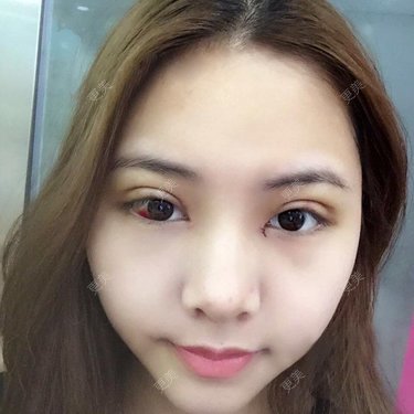 陈舒
