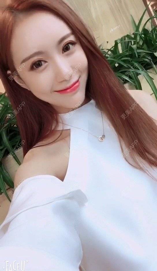 更美 - 小主播网红一枚😊的玻尿酸经验 | 注射美容 | 广州 | 玻尿酸
