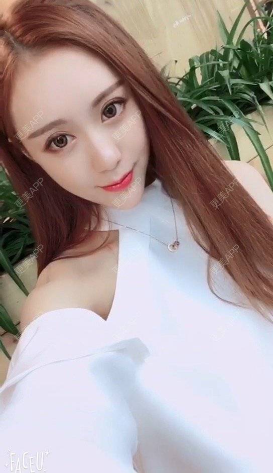 更美 - 小主播网红一枚😊的玻尿酸经验 | 注射美容 | 广州 | 玻尿酸