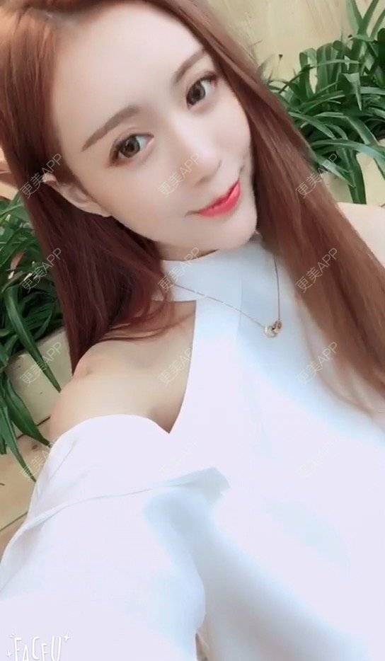 更美 - 小主播网红一枚😊的玻尿酸经验 | 注射美容 | 广州 | 玻尿酸
