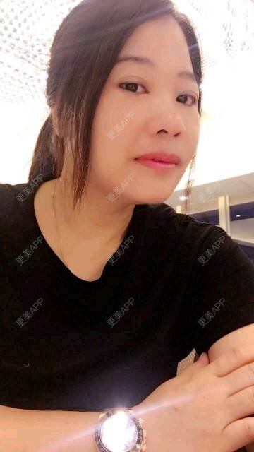 更美 - 深芩的埋线提升经验 | 埋线提升 | 面部轮廓 | 全面部提升 | 深圳