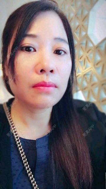 更美 - 深芩的埋线提升经验 | 埋线提升 | 面部轮廓 | 全面部提升 | 深圳