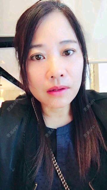 更美 - 深芩的埋线提升经验 | 埋线提升 | 面部轮廓 | 全面部提升 | 深圳