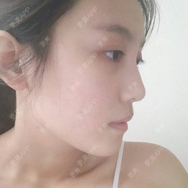 TT娜